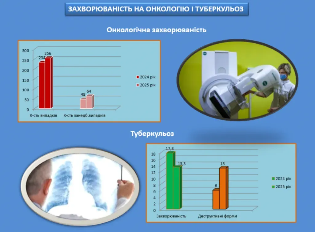 У Кременчуці зростає кількість запущених випадків онкологічних хвороб
